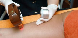 How Much Does Laser Hair Removal Cost?