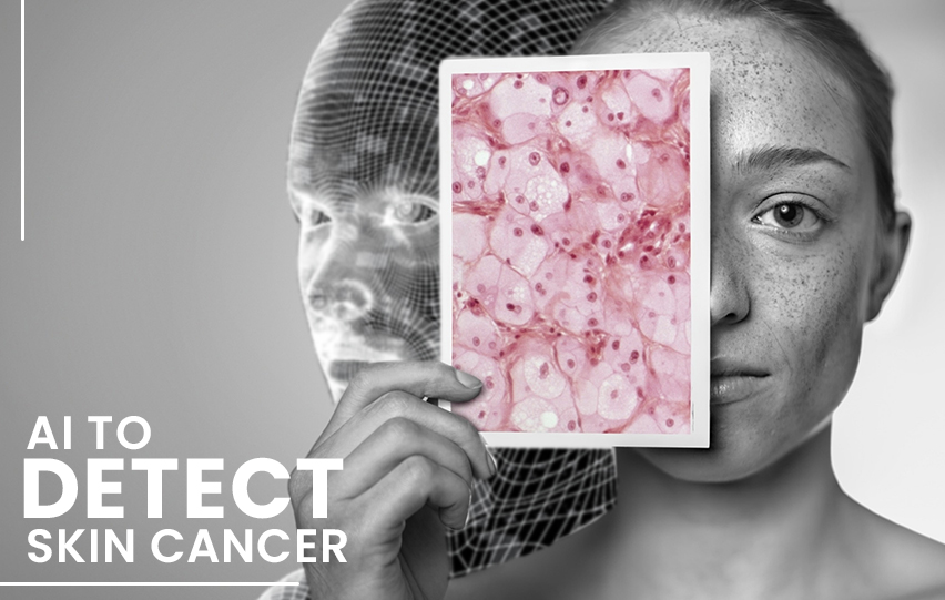 Artificial Intelligence Detect Skin Cancer