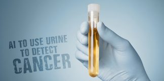 Urine to Detect Prostate Cancer